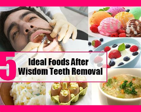 How Long Do You Have to Eat Soft Food After Tooth Extraction: A Journey Through Culinary Caution and Healing Horizons